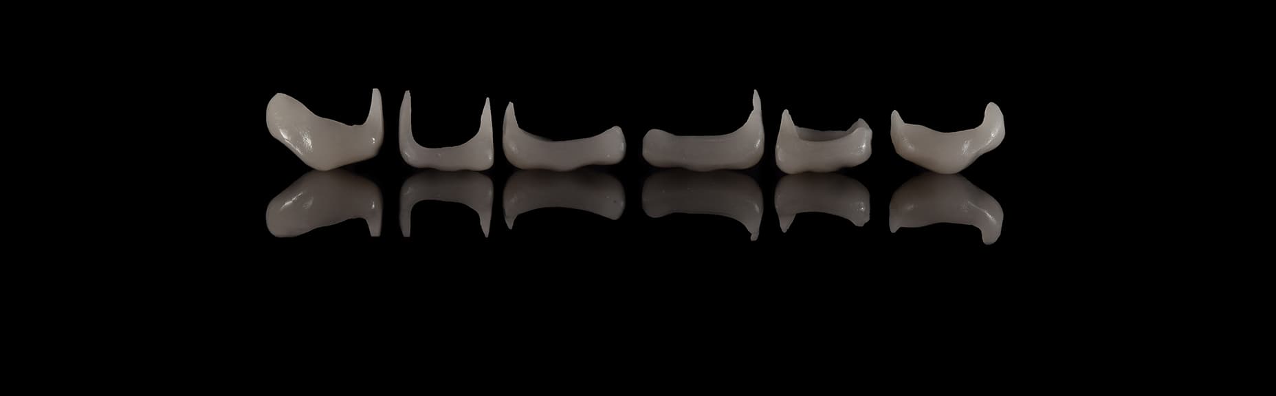 Coronas y puentes de cerámica elaborados en Casal Laboratorio Dental, Buenos Aires